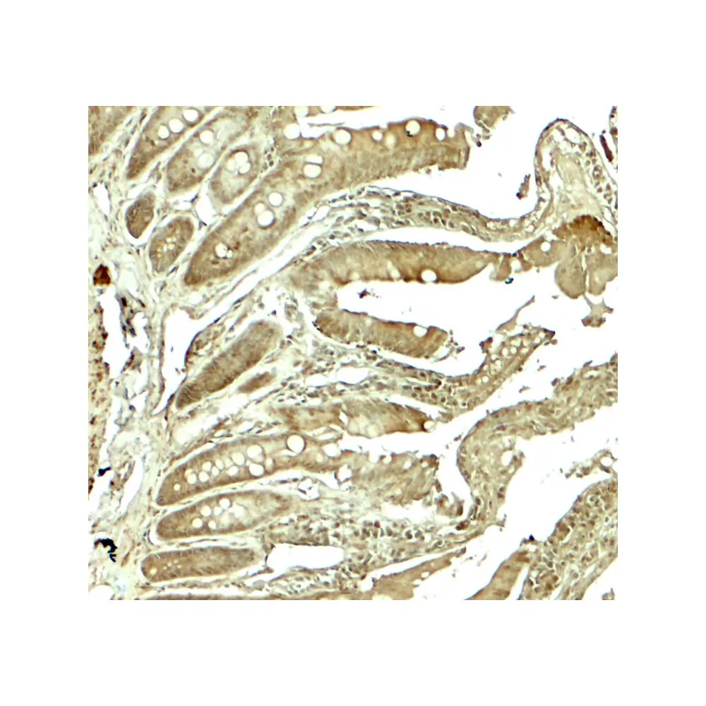 ProSci 8111 ADORA2B Antibody, ProSci, 0.1 mg/Unit Secondary Image