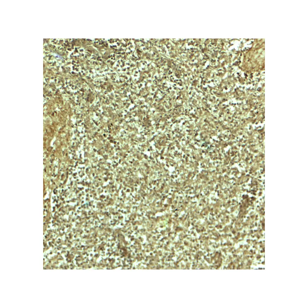 ProSci 8119 ADRM1 Antibody, ProSci, 0.1 mg/Unit Secondary Image
