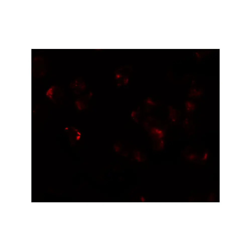 ProSci 6559 AFAP1L Antibody, ProSci, 0.1 mg/Unit Tertiary Image