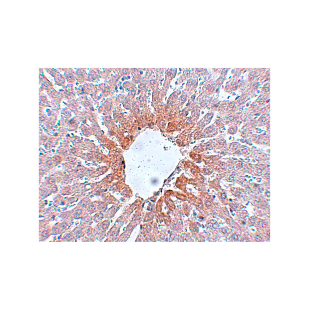ProSci 5393_S AGTR2 Antibody, ProSci, 0.02 mg/Unit Secondary Image