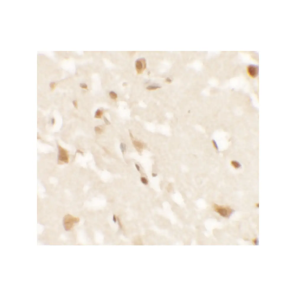 ProSci 6785 AIG1 Antibody, ProSci, 0.1 mg/Unit Secondary Image