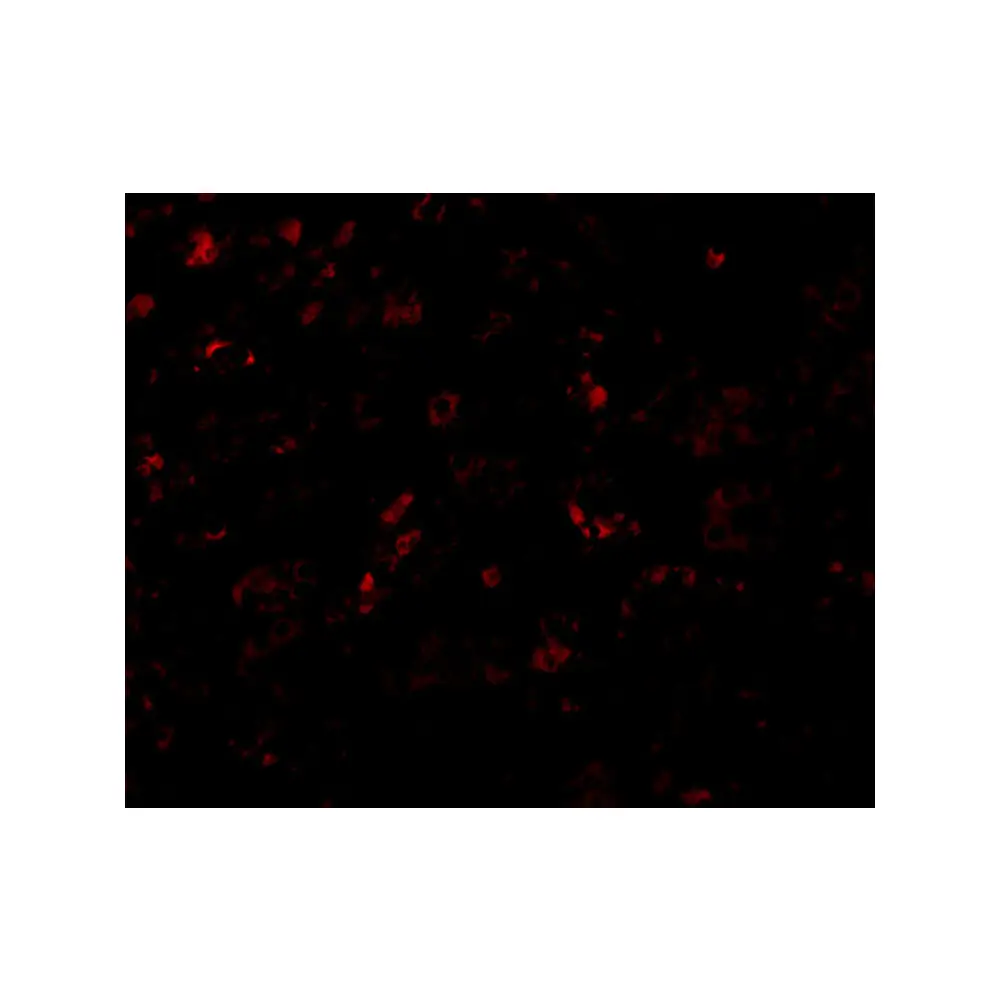 ProSci 5161_S AP2M1 Antibody, ProSci, 0.02 mg/Unit Tertiary Image