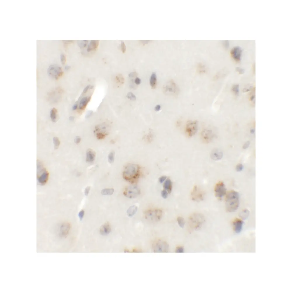 ProSci 6395 AP3B2 Antibody, ProSci, 0.1 mg/Unit Secondary Image