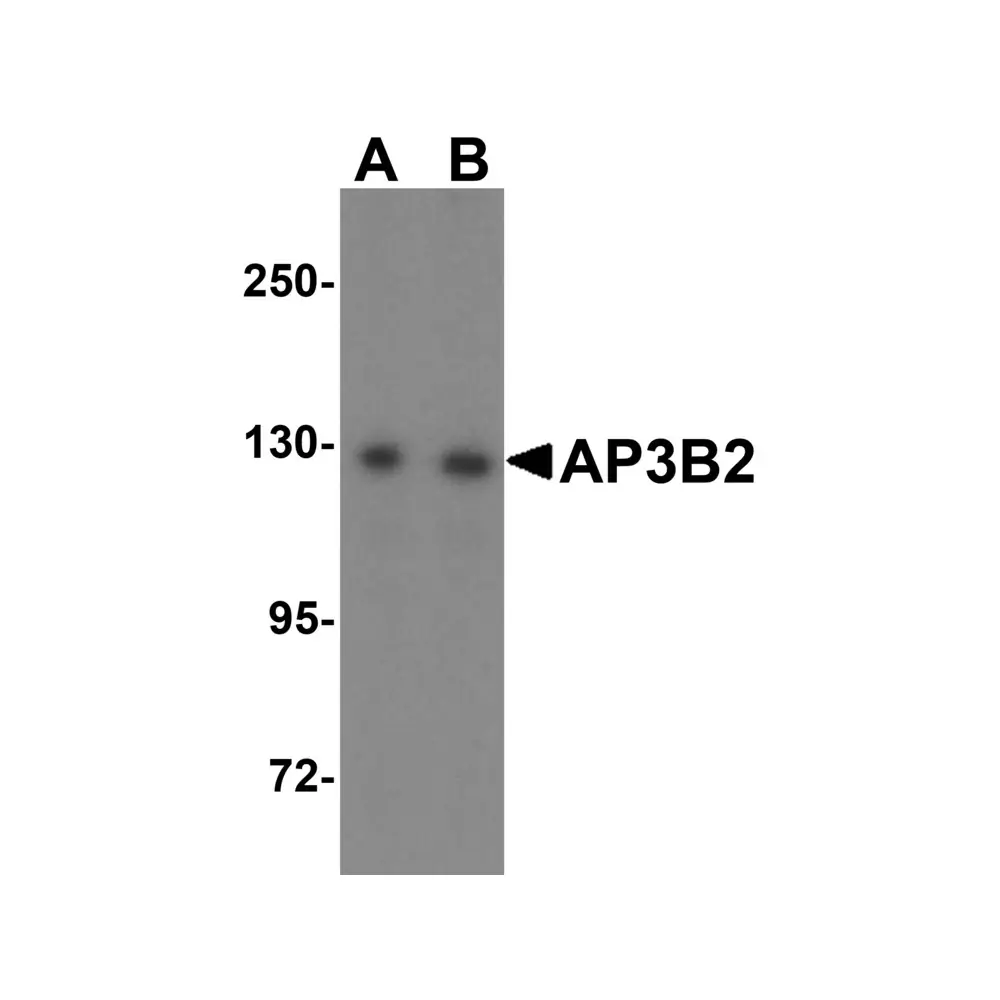 ProSci 6395 AP3B2 Antibody, ProSci, 0.1 mg/Unit Quaternary Image