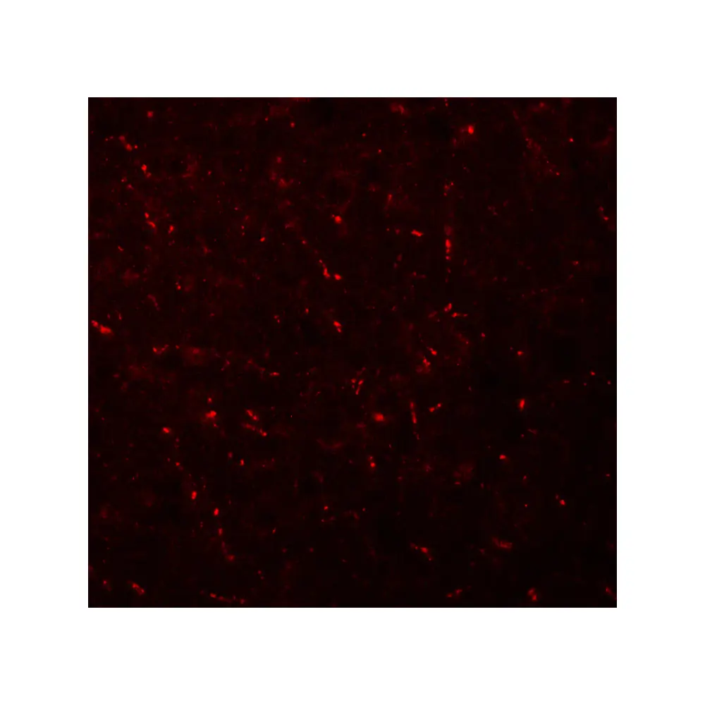 ProSci 6393 AP3M1 Antibody, ProSci, 0.1 mg/Unit Tertiary Image