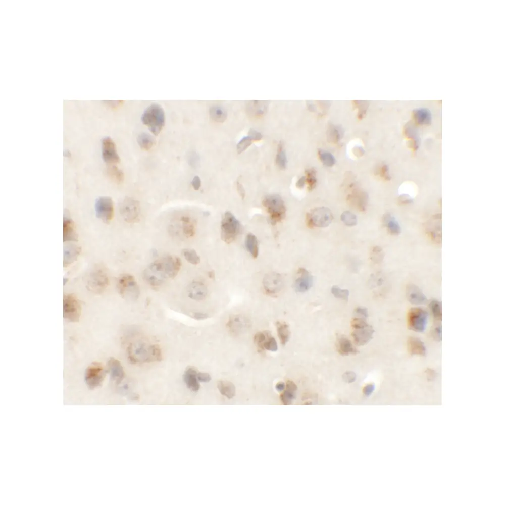 ProSci 6393 AP3M1 Antibody, ProSci, 0.1 mg/Unit Secondary Image