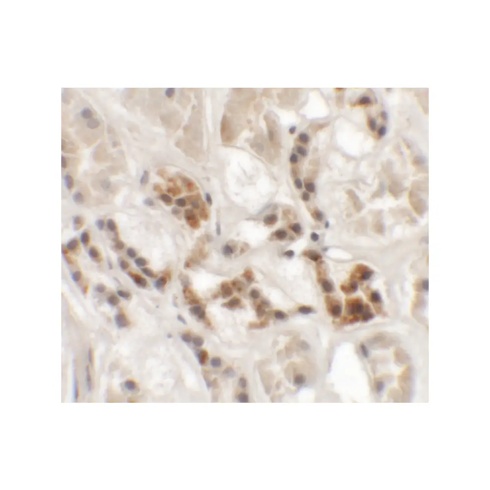 ProSci 6391 AP3S1 Antibody, ProSci, 0.1 mg/Unit Secondary Image