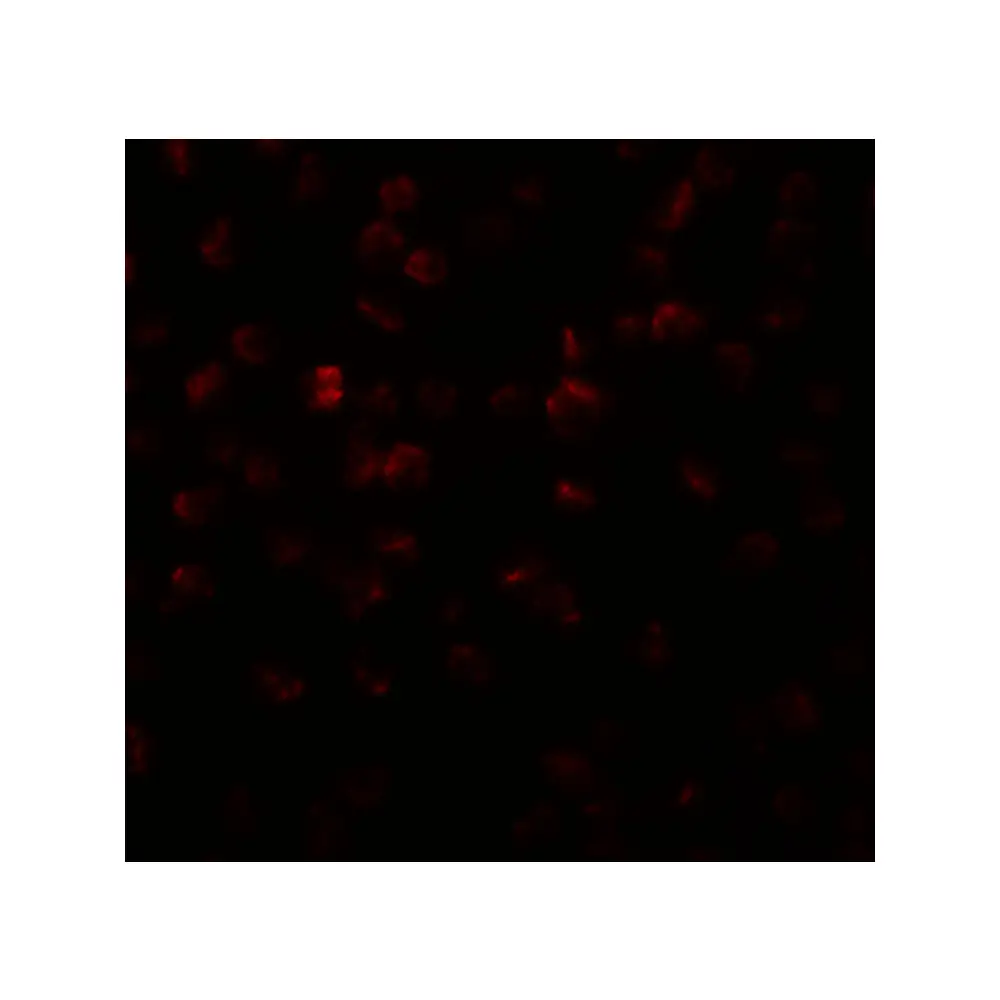 ProSci 5737 APC11 Antibody, ProSci, 0.1 mg/Unit Secondary Image