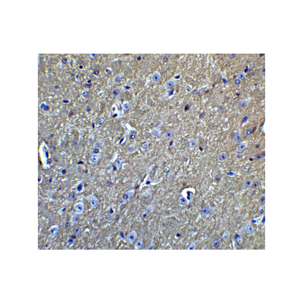 ProSci 2136_S APP Antibody, ProSci, 0.02 mg/Unit Quaternary Image