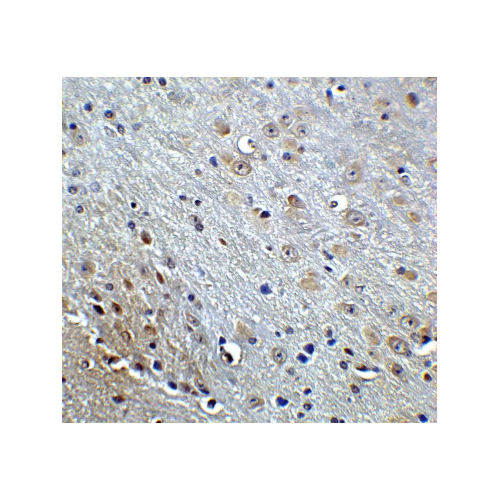 ProSci 5143_S APP Antibody, ProSci, 0.02 mg/Unit Quaternary Image