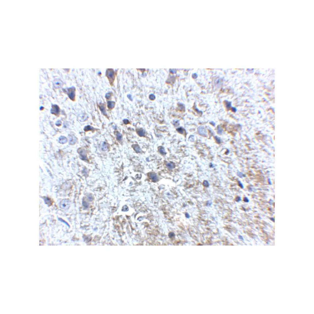 ProSci 5129_S APP Antibody, ProSci, 0.02 mg/Unit Secondary Image