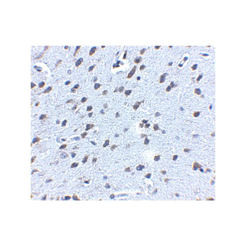 ProSci 5143 APP Antibody, ProSci, 0.1 mg/Unit Secondary Image
