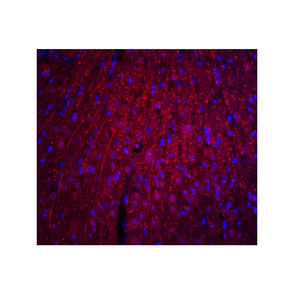 ProSci 8173 ARID1A Antibody, ProSci, 0.1 mg/Unit Quaternary Image
