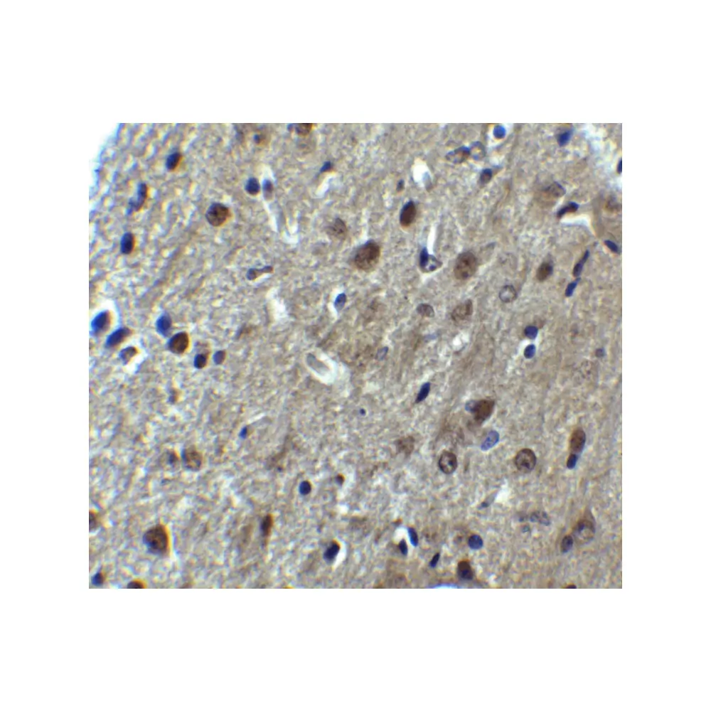 ProSci 8173 ARID1A Antibody, ProSci, 0.1 mg/Unit Secondary Image