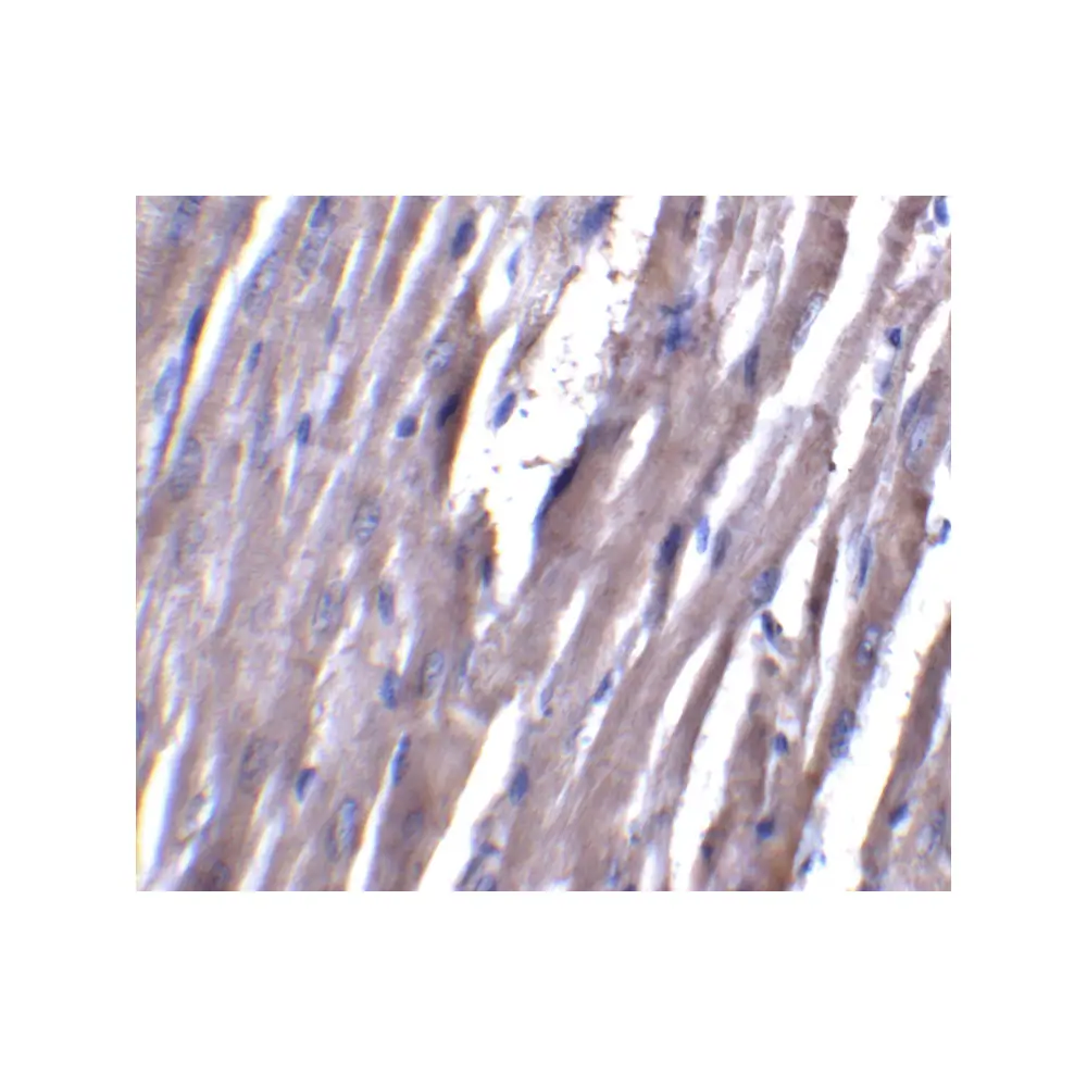 ProSci 4741 ASAH1 Antibody, ProSci, 0.1 mg/Unit Quaternary Image