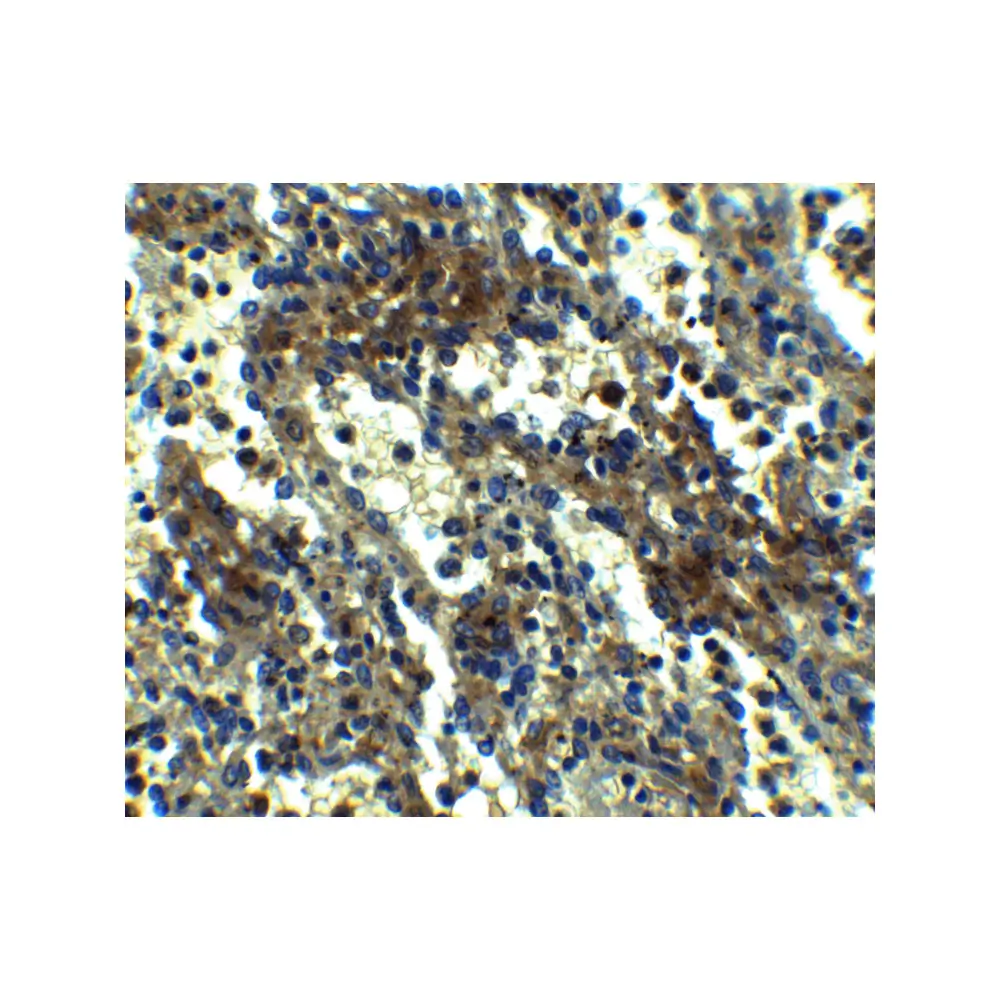 ProSci 2287 ASC Antibody, ProSci, 0.1 mg/Unit Quaternary Image
