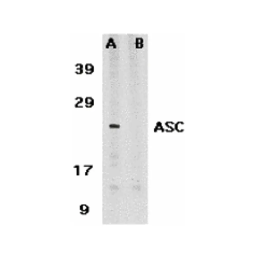 ProSci 2287_S ASC Antibody, ProSci, 0.02 mg/Unit Primary Image