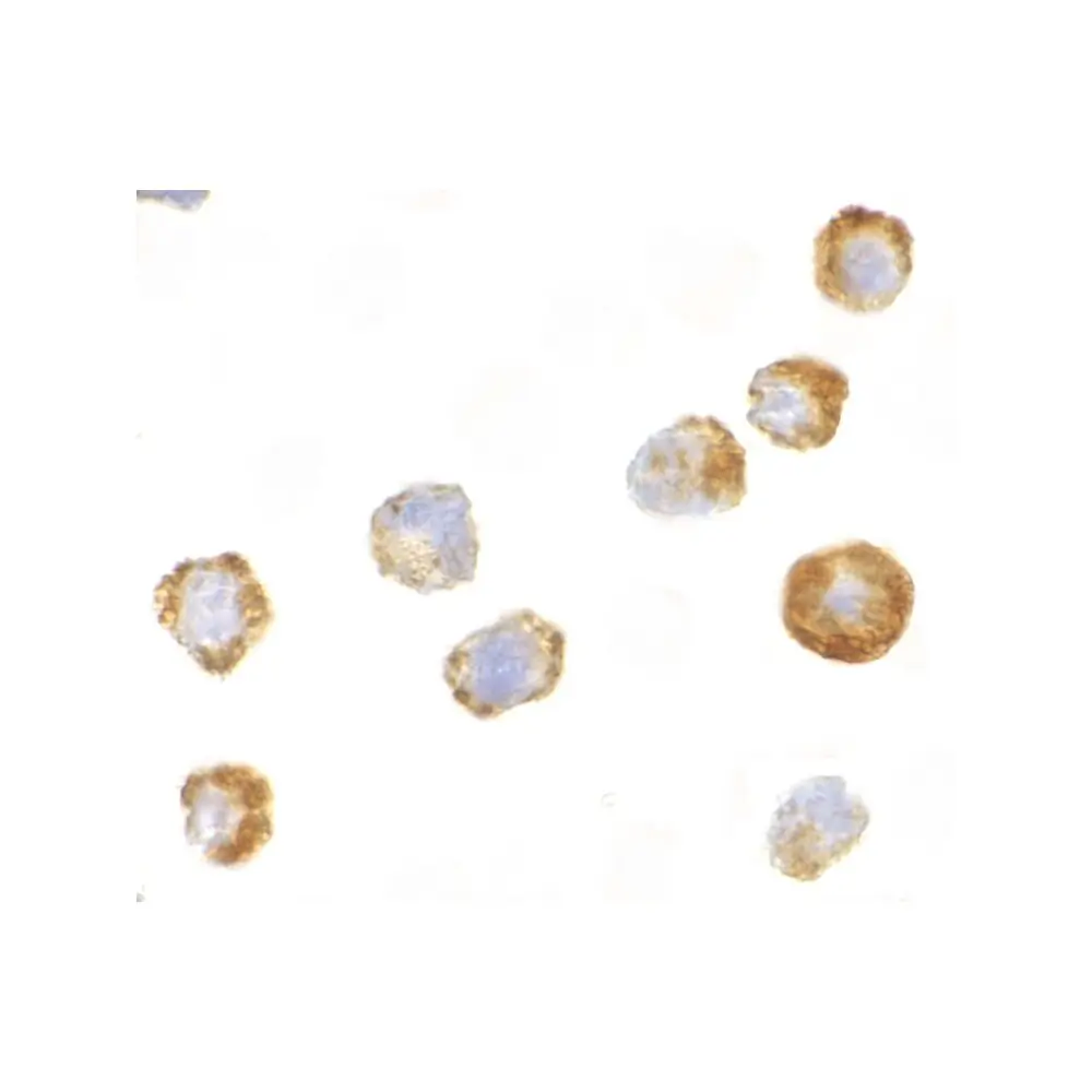 ProSci 3677_S ASK1 Antibody, ProSci, 0.02 mg/Unit Secondary Image