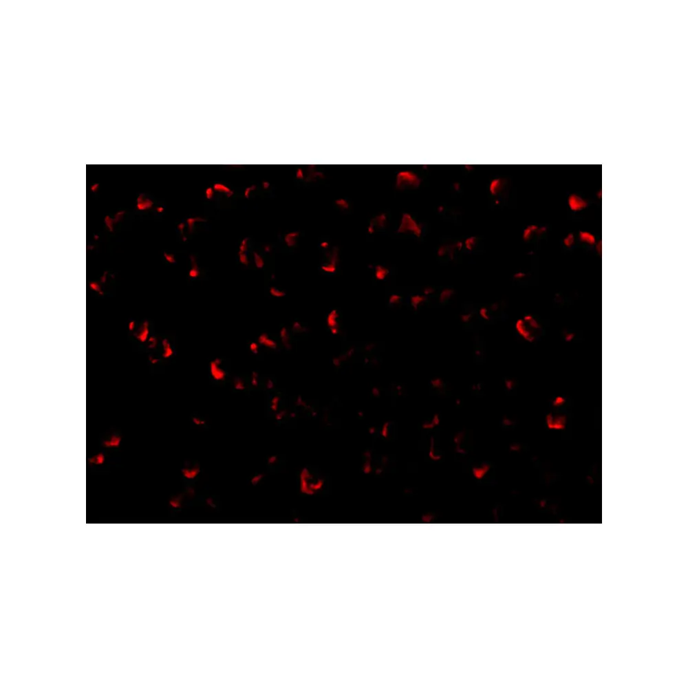 ProSci 1151 ASK1 Antibody, ProSci, 0.1 mg/Unit Tertiary Image