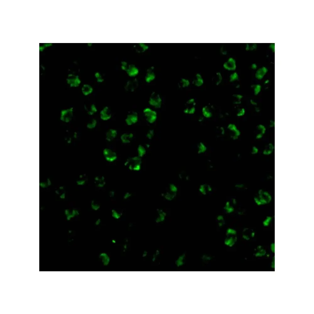 ProSci 3677_S ASK1 Antibody, ProSci, 0.02 mg/Unit Tertiary Image