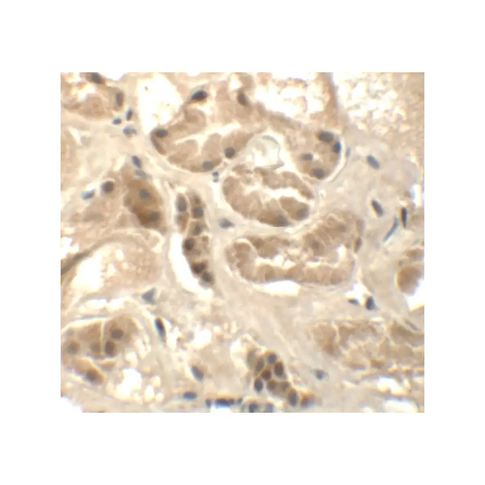 ProSci 6389_S ATAD3B Antibody, ProSci, 0.02 mg/Unit Secondary Image