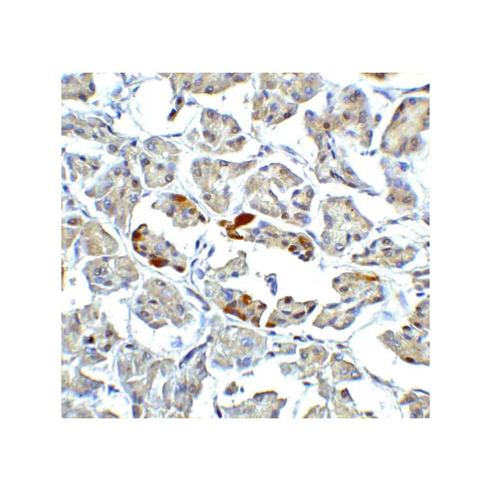 ProSci 3681 ATF6 Antibody, ProSci, 0.1 mg/Unit Senary Image