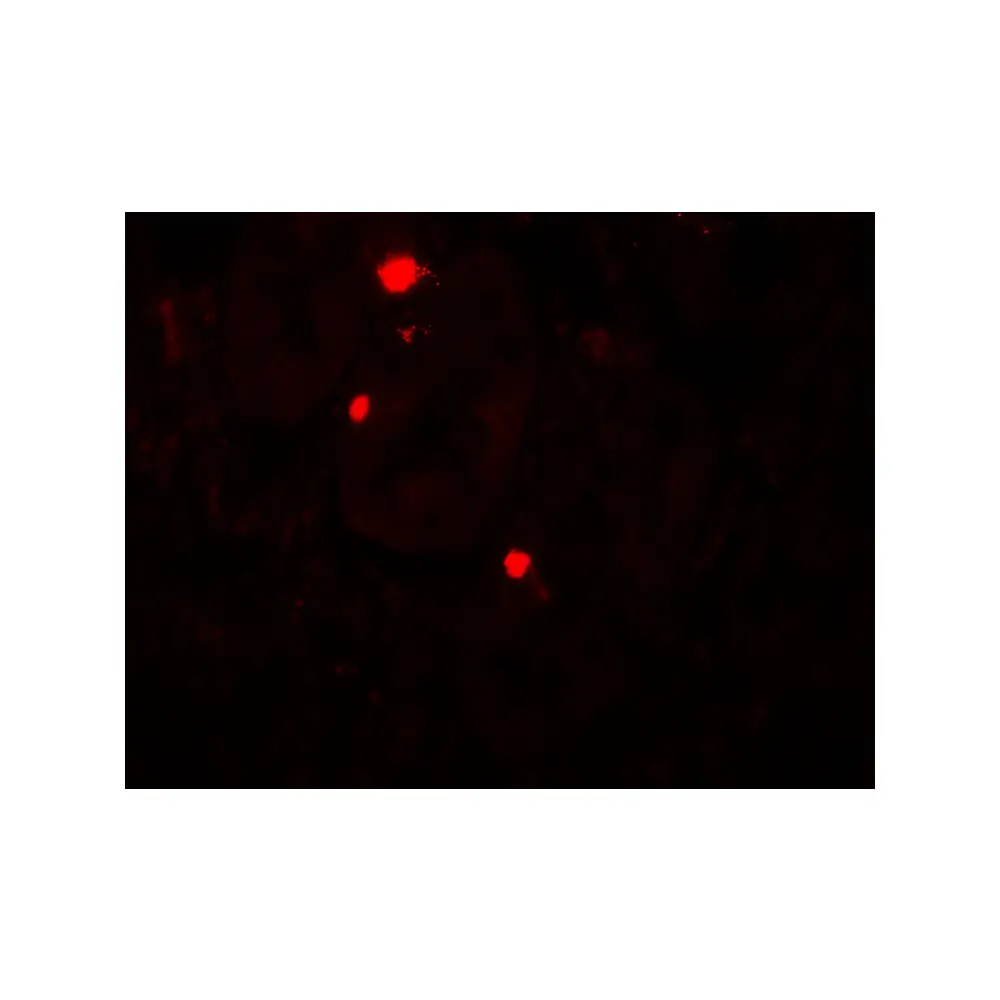 ProSci 7043 ATG14 Antibody, ProSci, 0.1 mg/Unit Secondary Image