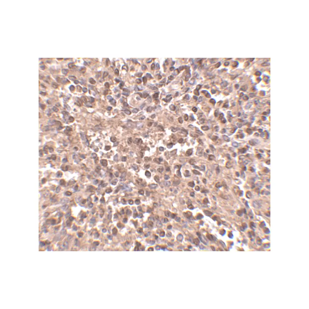 ProSci 4441_S ATG5 Antibody, ProSci, 0.02 mg/Unit Secondary Image
