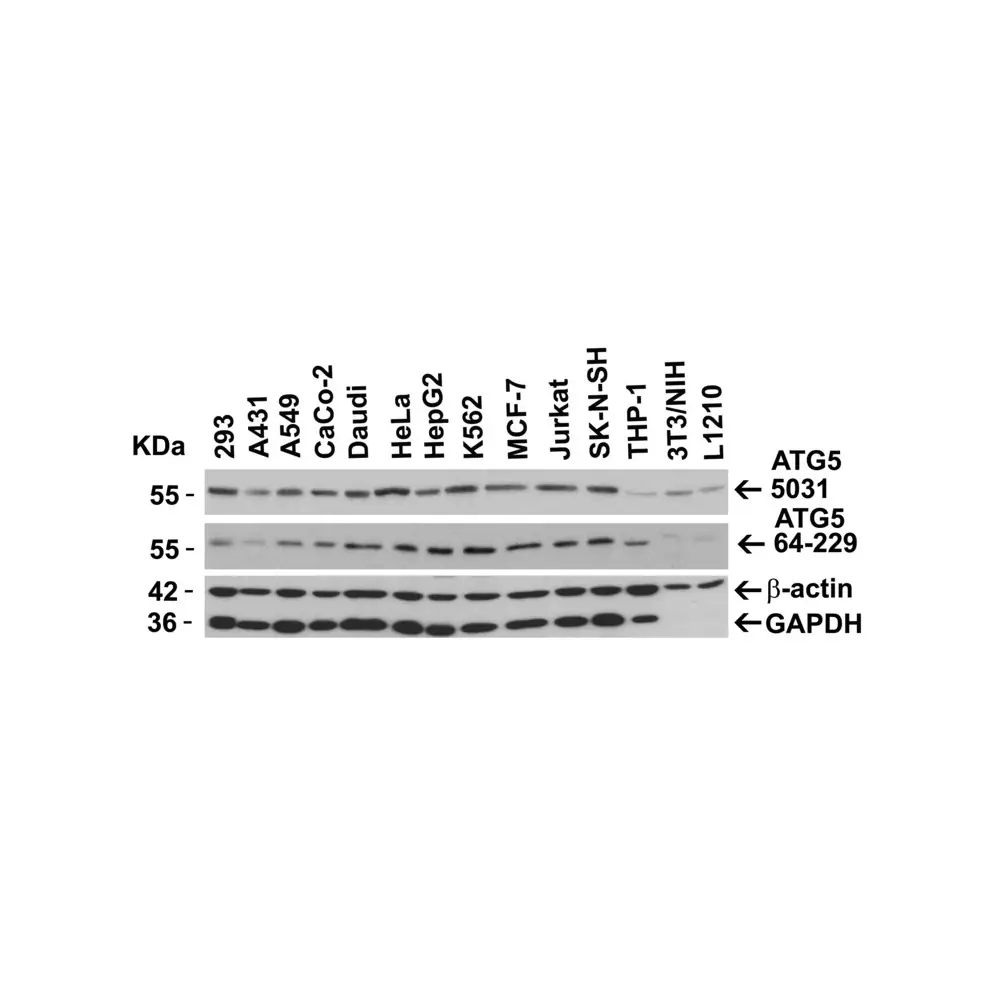 ProSci 5031_S ATG5 Antibody, ProSci, 0.02 mg/Unit Secondary Image