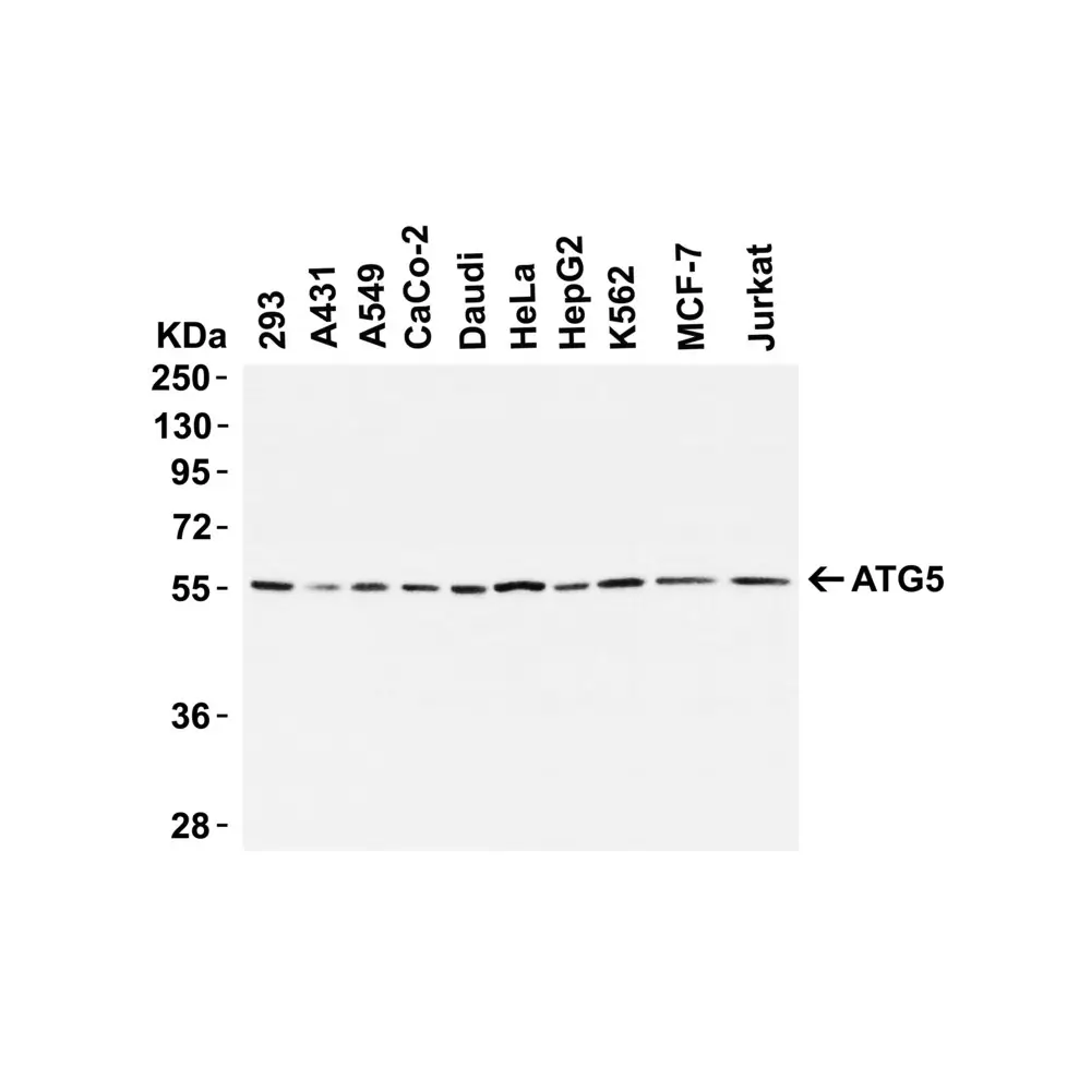 ProSci 5031_S ATG5 Antibody, ProSci, 0.02 mg/Unit Tertiary Image