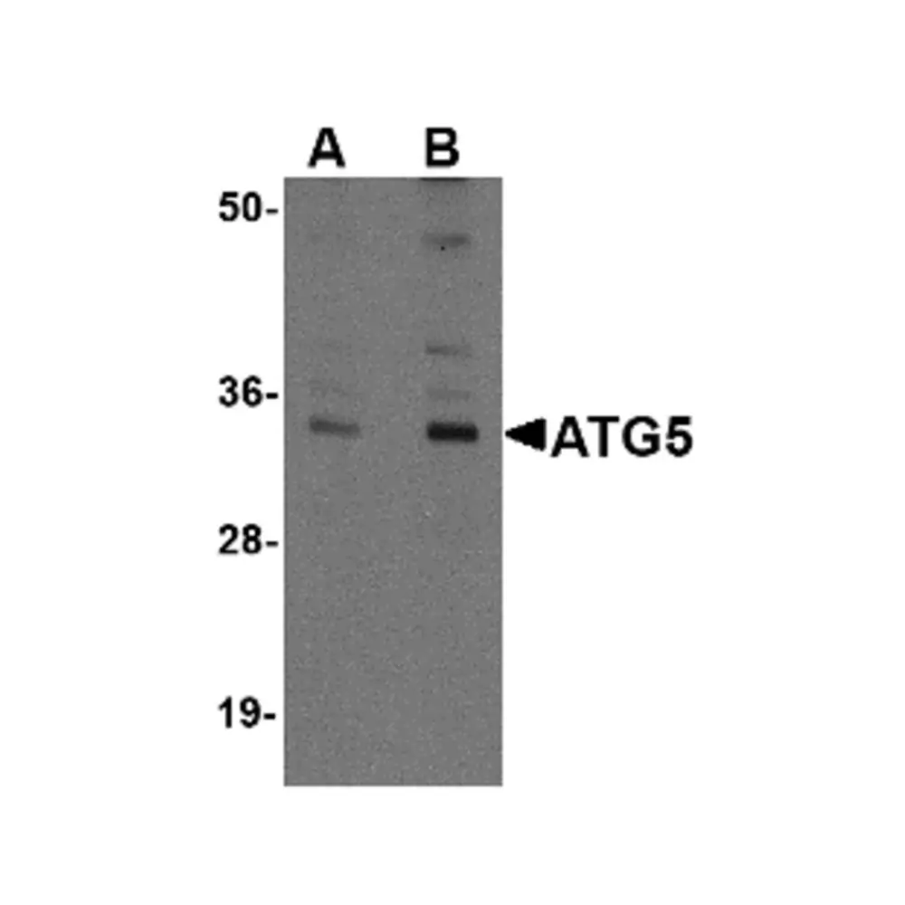 ProSci 5031_S ATG5 Antibody, ProSci, 0.02 mg/Unit Primary Image