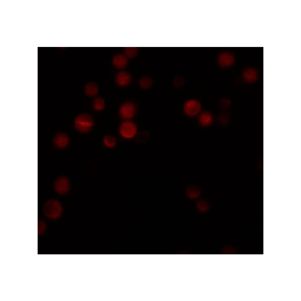 ProSci 5797_S ATG9B Antibody, ProSci, 0.02 mg/Unit Tertiary Image