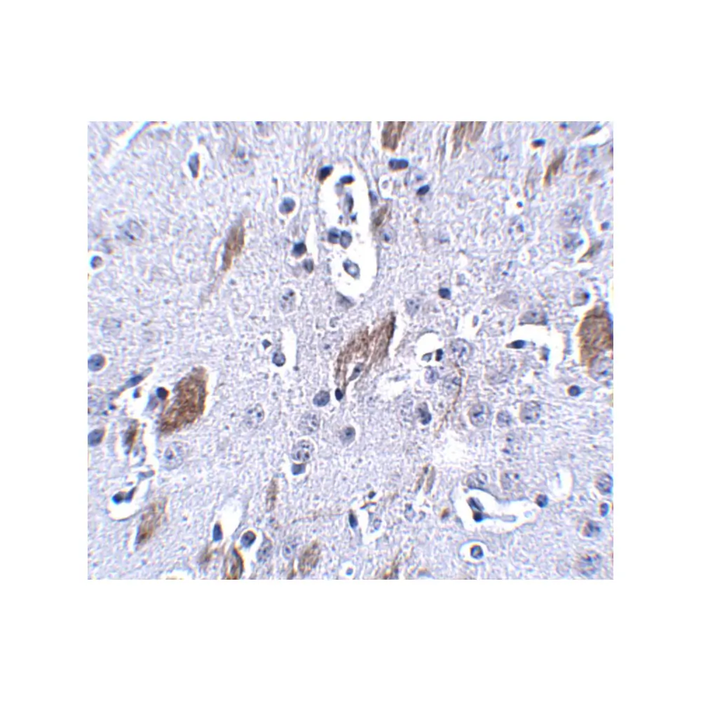 ProSci 5109_S ATOH8 Antibody, ProSci, 0.02 mg/Unit Secondary Image