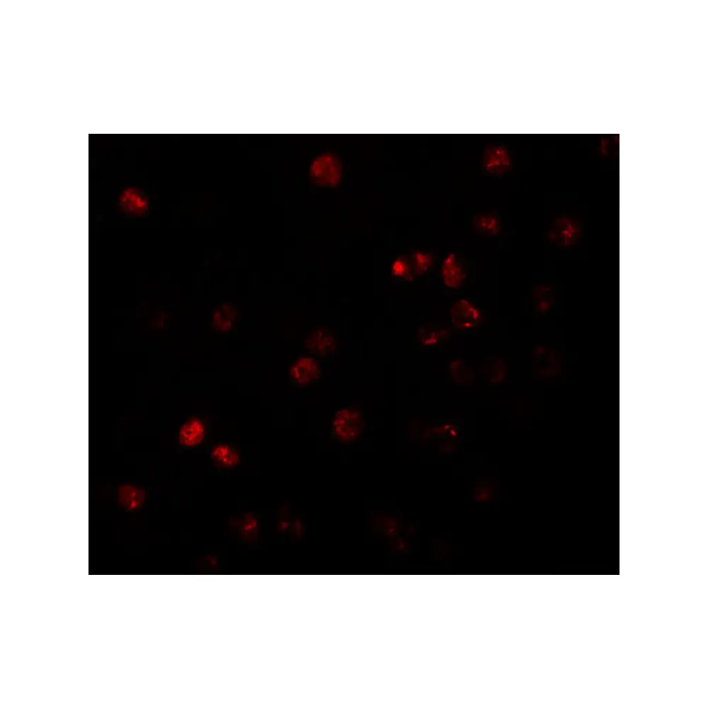 ProSci 5857 ATP11B Antibody, ProSci, 0.1 mg/Unit Tertiary Image