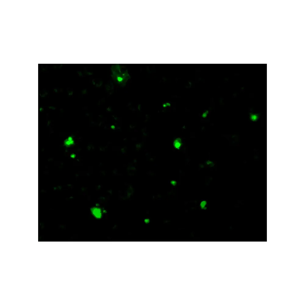 ProSci 2215 Acinus Antibody, ProSci, 0.1 mg/Unit Tertiary Image