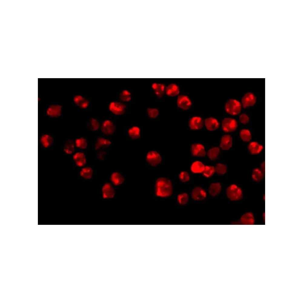 ProSci 2217_S Acinus Antibody, ProSci, 0.02 mg/Unit Tertiary Image