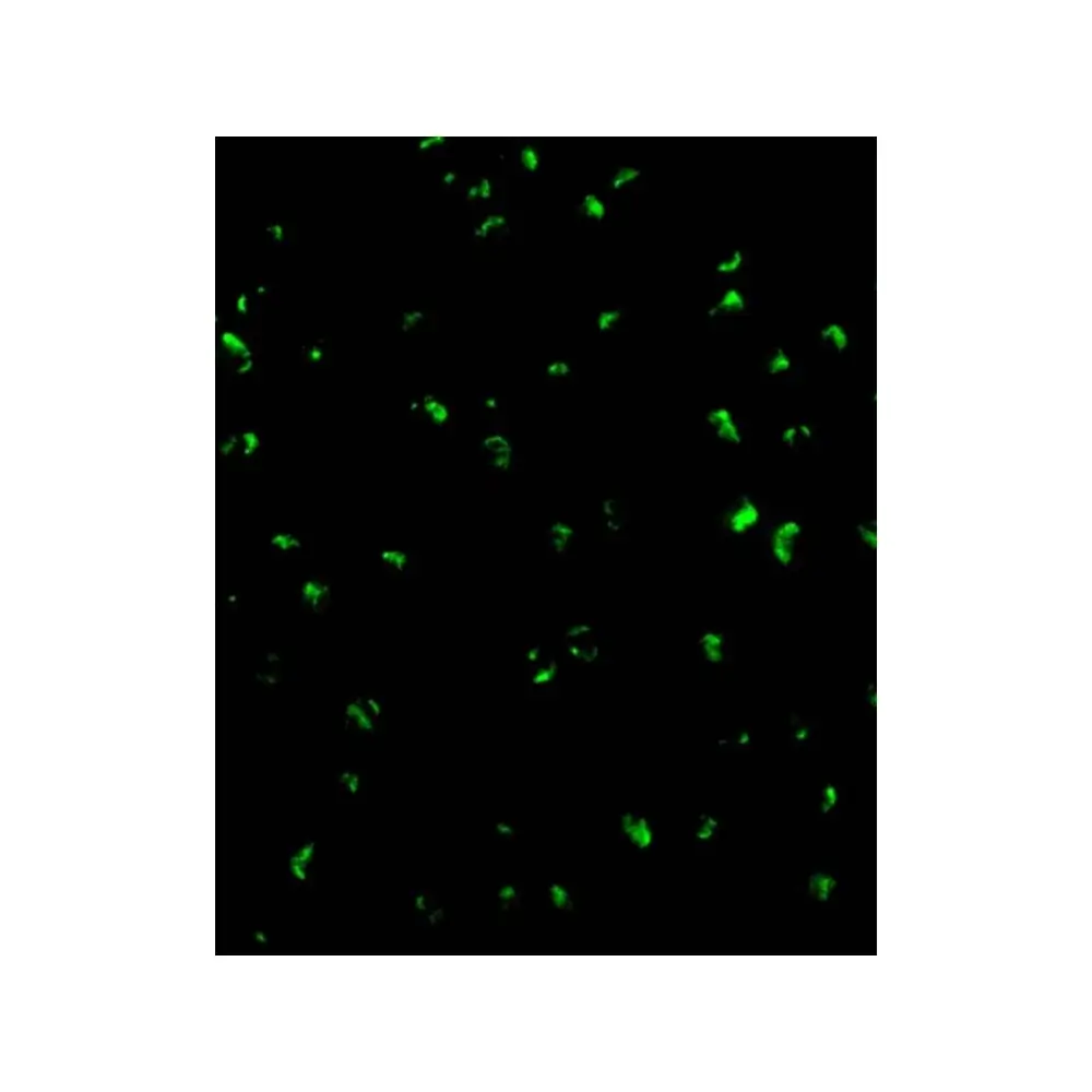 ProSci 2219 Acinus Antibody, ProSci, 0.1 mg/Unit Tertiary Image