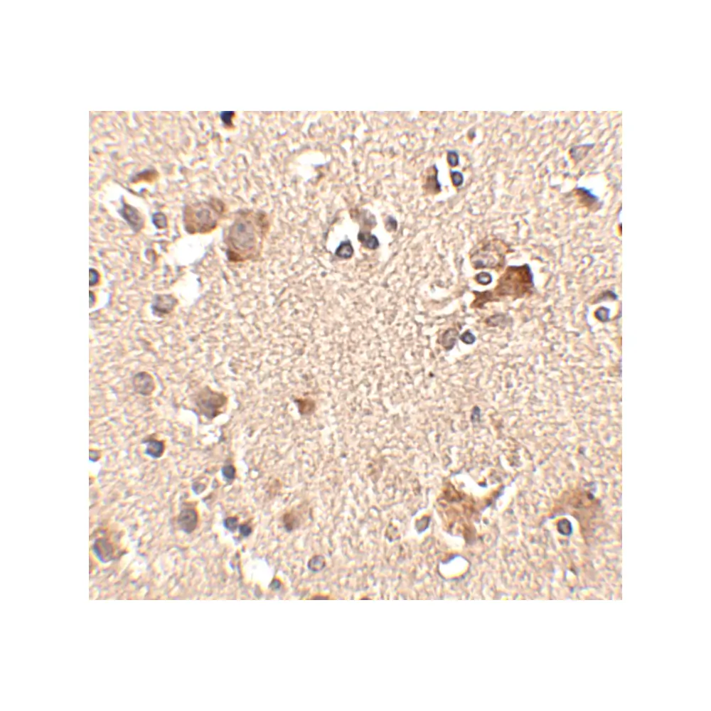 ProSci 4865 Aipl1 Antibody, ProSci, 0.1 mg/Unit Secondary Image