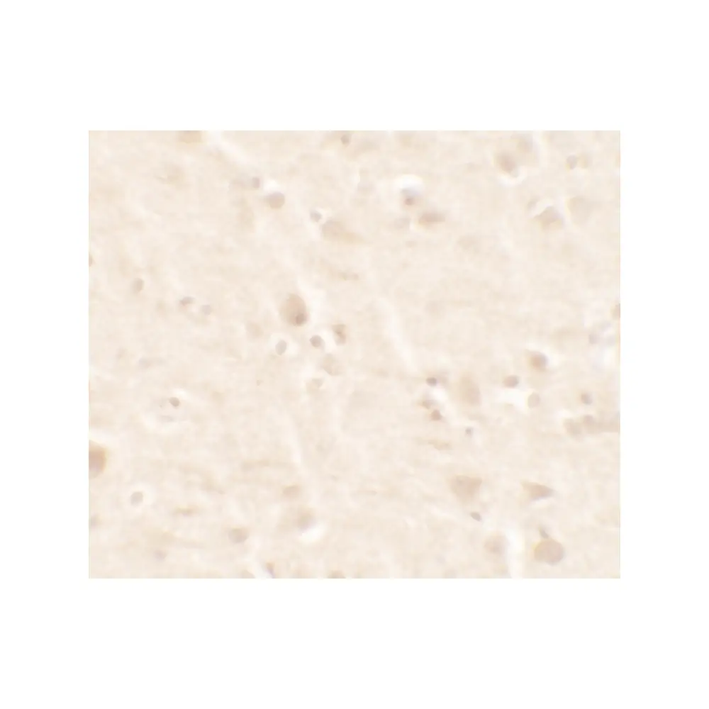 ProSci 7439 B2M Antibody, ProSci, 0.1 mg/Unit Secondary Image