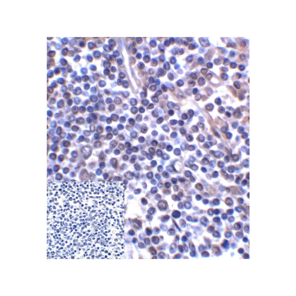 ProSci RF16095_S B7H3 Antibody [10G6], ProSci, 0.02 mg/Unit Quaternary Image