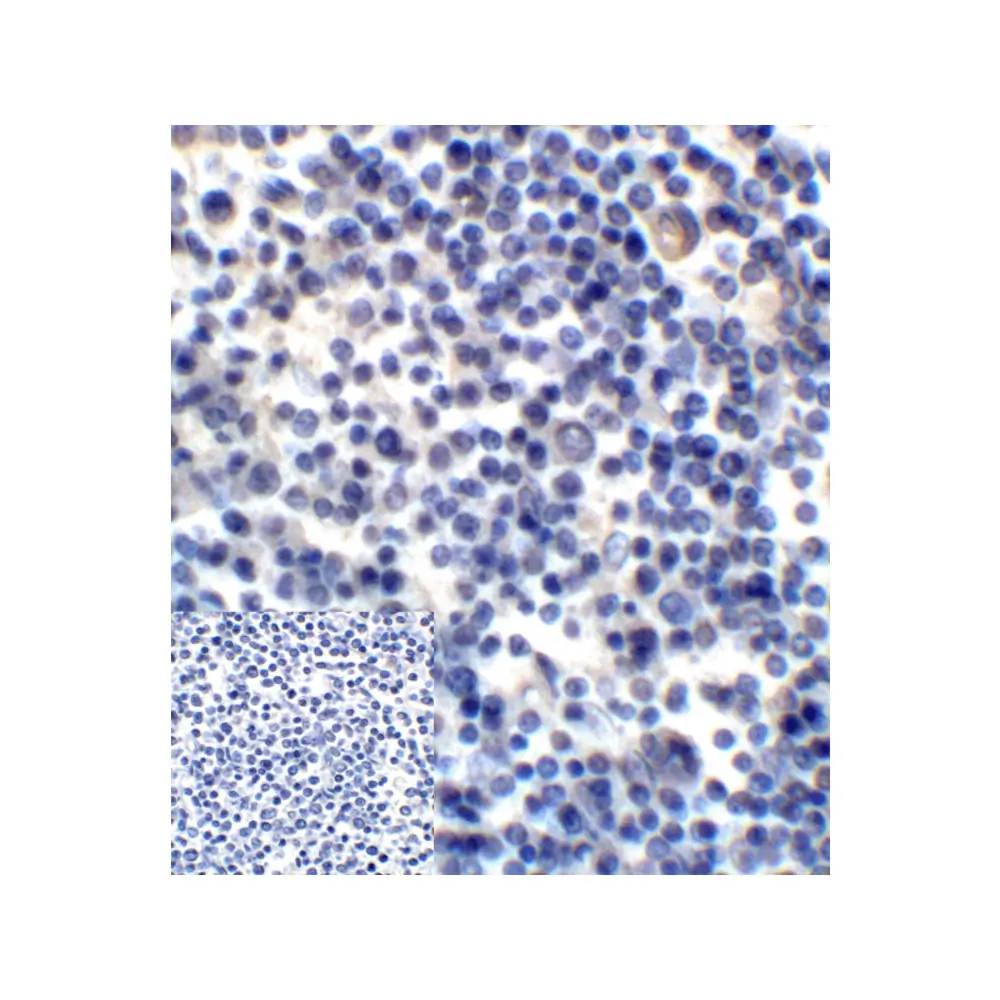 ProSci RF16091_S B7H3 Antibody [2H5], ProSci, 0.02 mg/Unit Quaternary Image