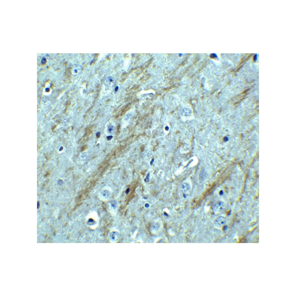 ProSci 2253_S BACE Antibody, ProSci, 0.02 mg/Unit Tertiary Image