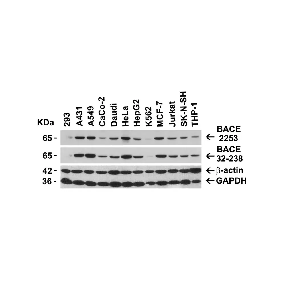 ProSci 2253_S BACE Antibody, ProSci, 0.02 mg/Unit Secondary Image