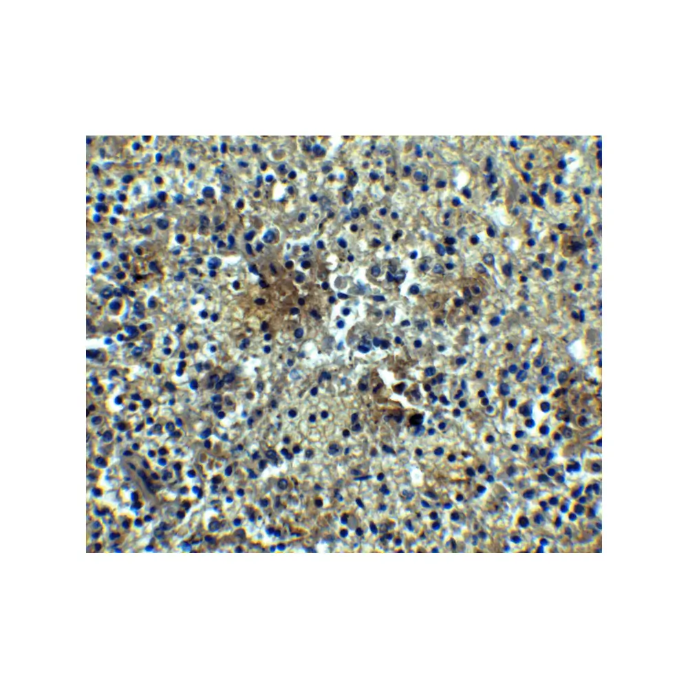 ProSci 3097_S BAFF Receptor Antibody, ProSci, 0.02 mg/Unit Secondary Image