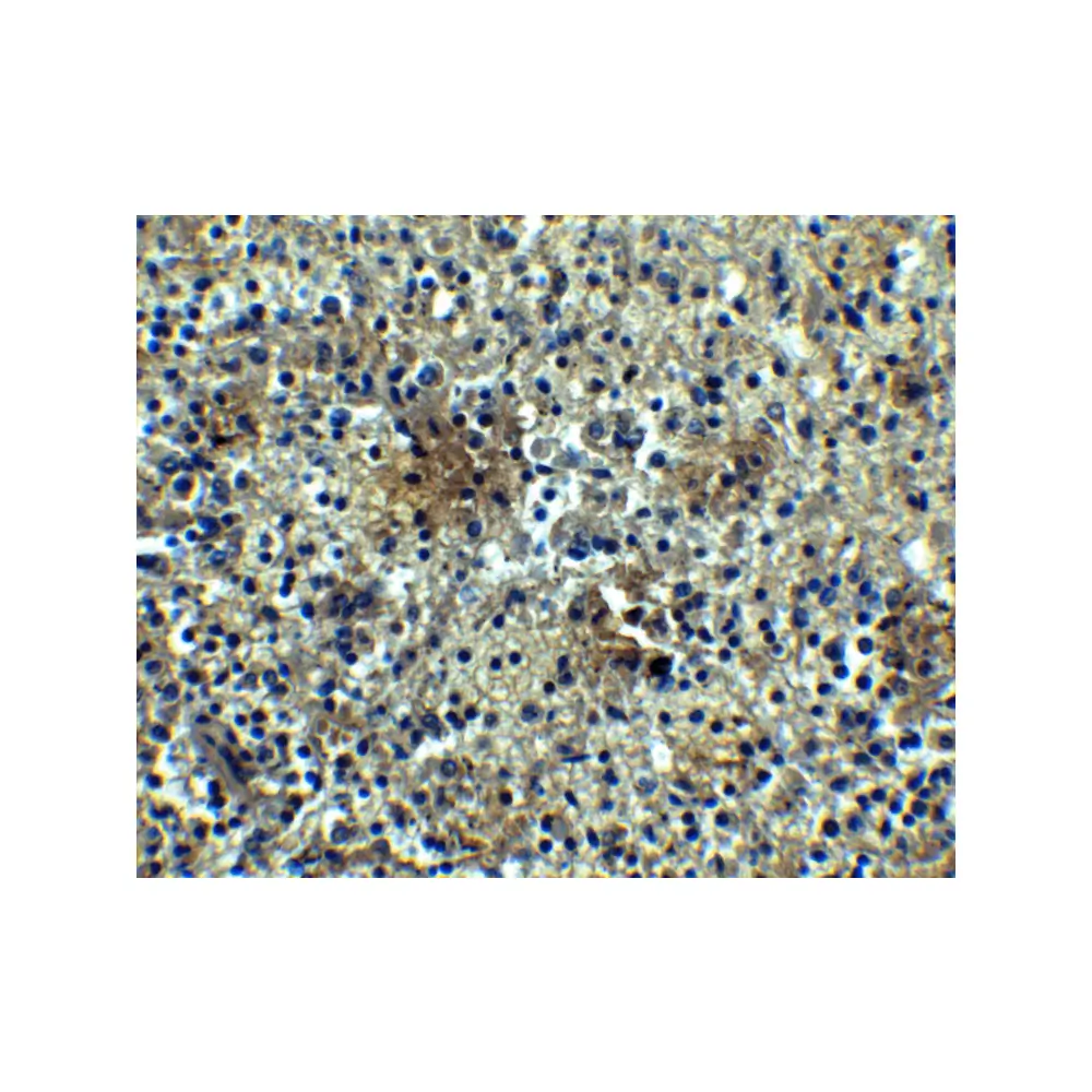 ProSci 3097 BAFF Receptor Antibody, ProSci, 0.1 mg/Unit Secondary Image