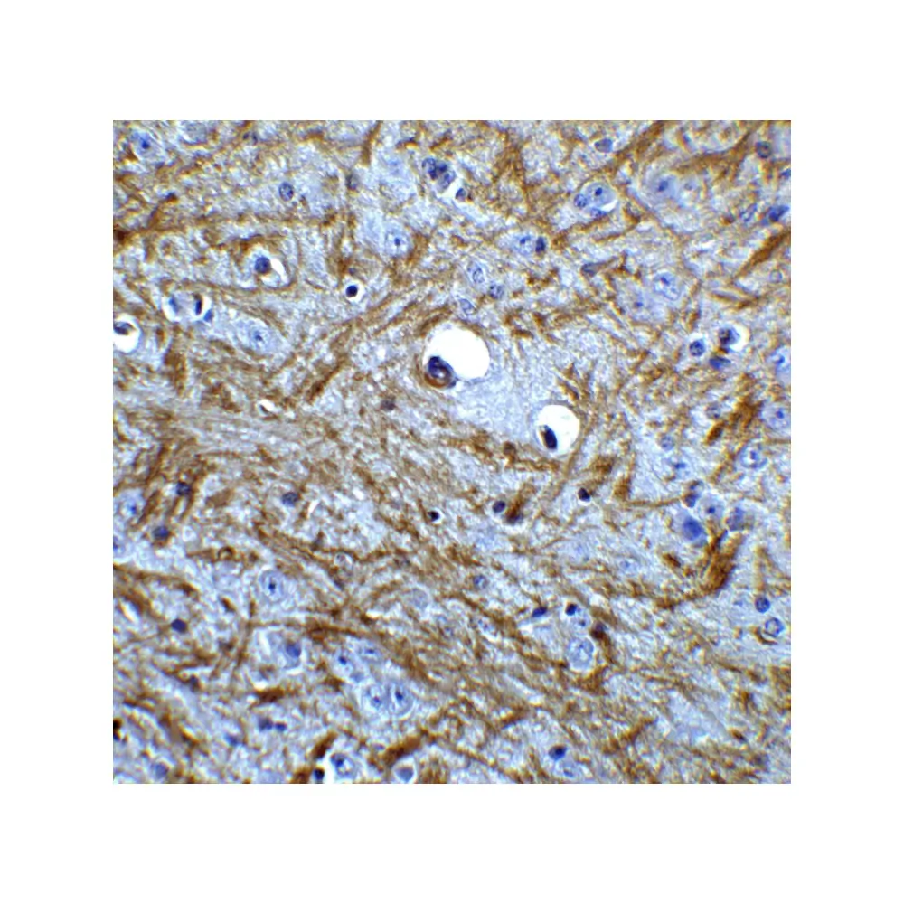 ProSci 3869_S BAG-1 Antibody, ProSci, 0.02 mg/Unit Secondary Image
