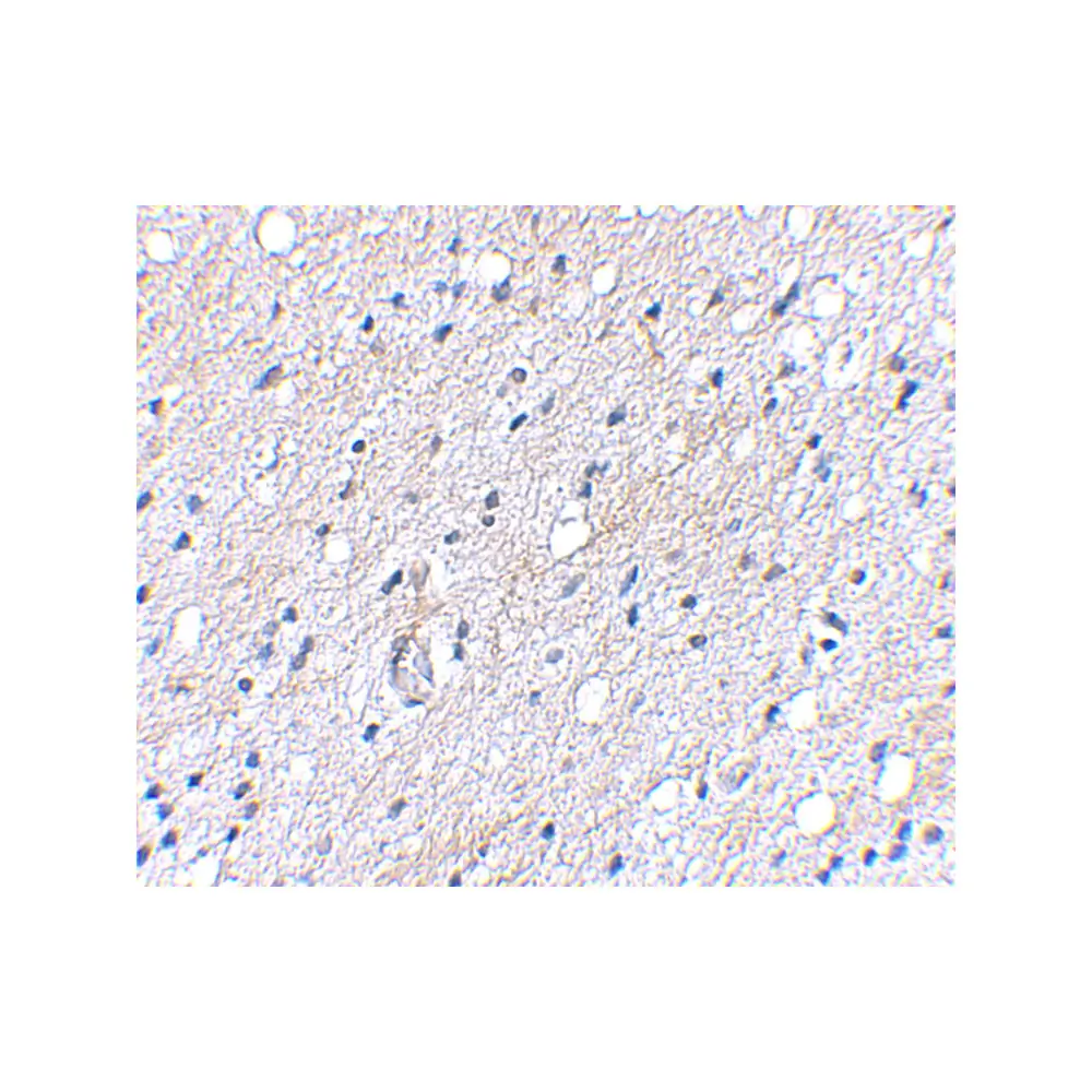 ProSci 4505_S BAP3 Antibody, ProSci, 0.02 mg/Unit Secondary Image