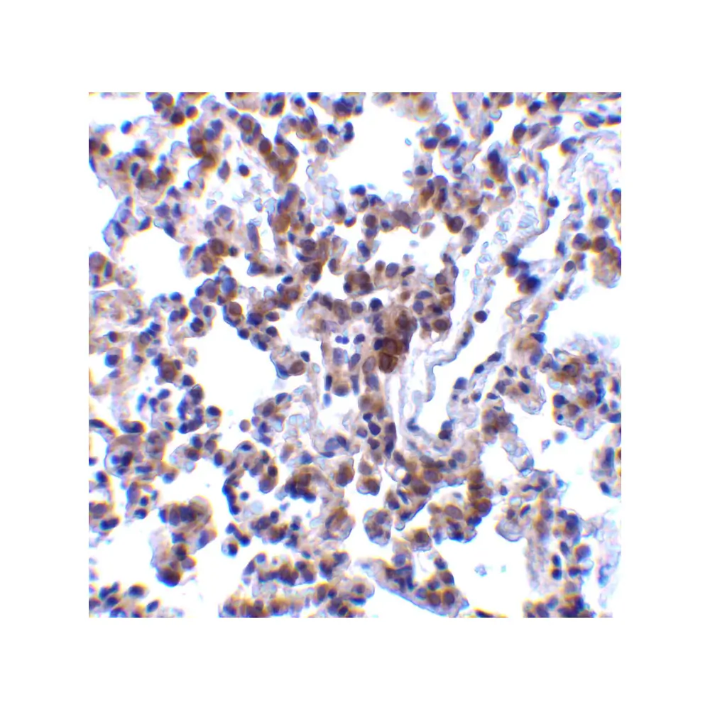 ProSci 3665 BAP31 Antibody, ProSci, 0.1 mg/Unit Quaternary Image