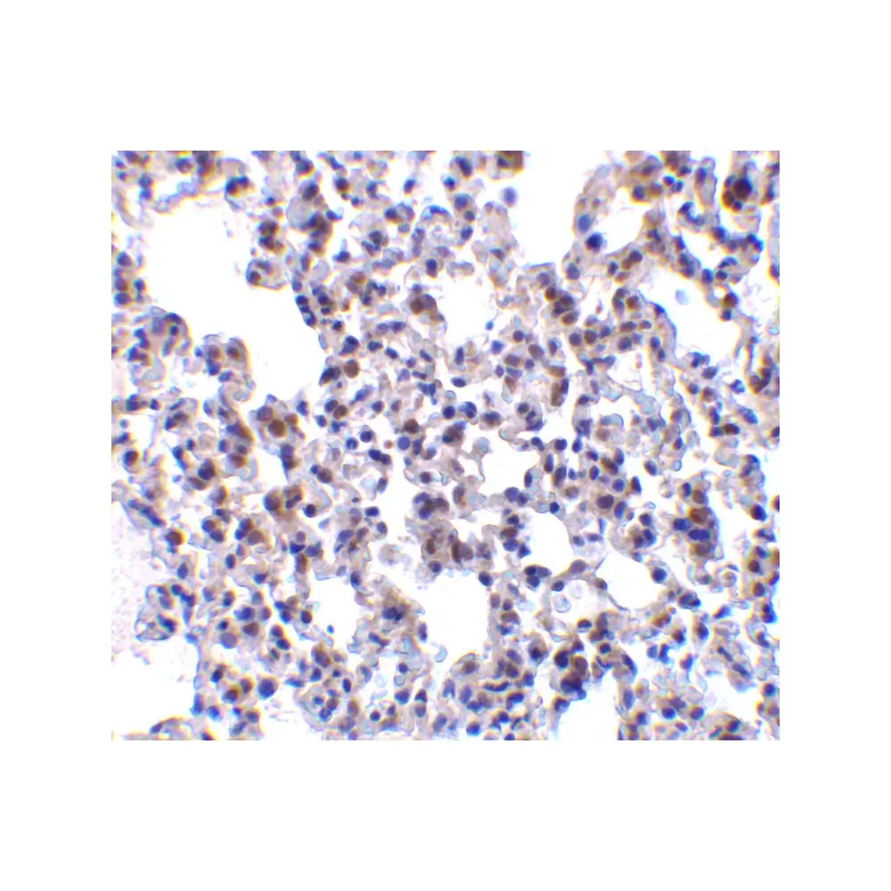 ProSci 3675 BAP31 Antibody, ProSci, 0.1 mg/Unit Quaternary Image