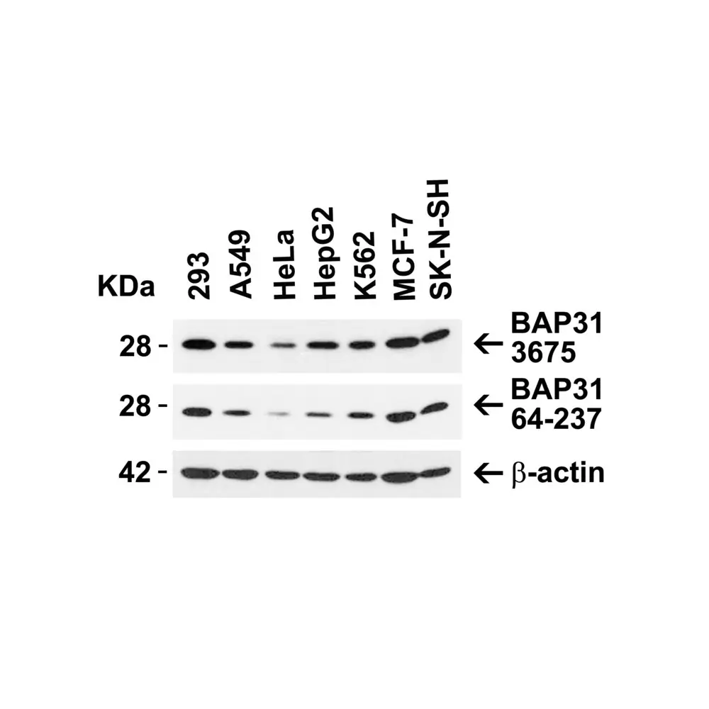 ProSci 3675 BAP31 Antibody, ProSci, 0.1 mg/Unit Secondary Image